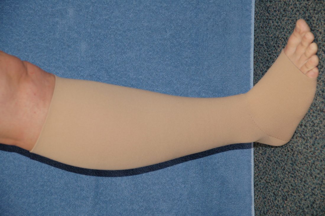 lymphedema-compression-garments - Physical Rehabilitation, Concussion  Rehabilitation and Lymphatic Drainage